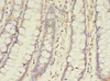 Immunohistochemistry of paraffin-embedded human colon tissue using CSB-PA755482LA01HU at dilution of 1:100