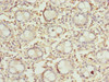 Immunohistochemistry of paraffin-embedded human colon tissue using CSB-PA757108LA01HU at dilution of 1:100