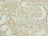 Immunohistochemistry of paraffin-embedded human kidney tissue using CSB-PA759172LA01HU at dilution of 1:100