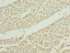 Immunohistochemistry of paraffin-embedded human heart tissue using CSB-PA759172LA01HU at dilution of 1:100