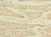 Immunohistochemistry of paraffin-embedded human gastric cancer using CSB-PA760708LA01HU at dilution of 1:100