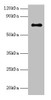 Western blot<br />
 All lanes: Adck2 antibody at 2µg/ml + K562 whole cell lysate<br />
 Secondary<br />
 Goat polyclonal to rabbit IgG at 1/15000 dilution<br />
 Predicted band size: 69 kDa<br />
 Observed band size: 69 kDa<br />
