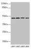 Western blot<br />
 All lanes: NAPEPLD antibody at 6µg/ml<br />
 Lane 1: Mouse large intestine tissue<br />
 Lane 2: Mouse kidney tissue<br />
 Lane 3: Mouse stomach tissue<br />
 Lane 4: MCF-7 whole cell lysate<br />
 Secondary<br />
 Goat polyclonal to rabbit IgG at 1/10000 dilution<br />
 Predicted band size: 46 kDa<br />
 Observed band size: 46 kDa<br />