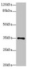 Western blot<br />
 All lanes: MED27 antibody at 0.5µg/ml + A431 whole cell lysate<br />
 Secondary<br />
 Goat polyclonal to rabbit IgG at 1/10000 dilution<br />
 Predicted band size: 36, 32, 15 kDa<br />
 Observed band size: 36 kDa<br /> Western blot<br />
 All lanes: MED27 antibody at 0.5µg/ml + A431 whole cell lysate<br />
 Secondary<br />
 Goat polyclonal to rabbit IgG at 1/10000 dilution<br />
 Predicted band size: 36, 32, 15 kDa<br />
 Observed band size: 36 kDa<br />