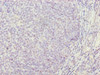 Immunohistochemistry of paraffin-embedded human tonsil tissue using CSB-PA764808LA01HU at dilution of 1:100
