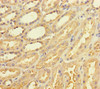 Immunohistochemistry of paraffin-embedded human kidney tissue using CSB-PA766403LA01HU at dilution of 1:100