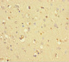 Immunohistochemistry of paraffin-embedded human brain tissue using CSB-PA772019LA01HU at dilution of 1:100