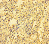 Immunohistochemistry of paraffin-embedded human spleen tissue using CSB-PA772035LA01HU at dilution of 1:100