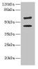 Western blot<br />
 All lanes: KRT73 antibody at 4µg/ml + HepG2 whole cell lysate<br />
 Secondary<br />
 Goat polyclonal to rabbit IgG at 1/10000 dilution<br />
 Predicted band size: 59, 42 kDa<br />
 Observed band size: 59, 42 kDa<br />