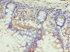 Immunohistochemistry of paraffin-embedded human small intestine tissue using CSB-PA800097LA01HU at dilution of 1:100 Immunohistochemistry of paraffin-embedded human small intestine tissue using CSB-PA800097LA01HU at dilution of 1:100