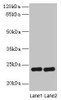 Western blot<br />
 All lanes: RD3 antibody at 0.5µg/ml<br />
 Lane 1: Mouse thymus tissue<br />
 Lane 2: Human placenta tissue<br />
 Secondary<br />
 Goat polyclonal to rabbit IgG at 1/10000 dilution<br />
 Predicted band size: 23 kDa<br />
 Observed band size: 23 kDa<br />