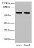 Western blot<br />
 All lanes: Hmgcs1 antibody at 12µg/ml<br />
 Lane 1: NIH/3T3 whole cell lysate<br />
 Lane 2: Mouse liver tissue<br />
 Secondary<br />
 Goat polyclonal to rabbit IgG at 1/10000 dilution<br />
 Predicted band size: 58 kDa<br />
 Observed band size: 58 kDa<br />