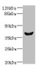 Western blot<br />
 All lanes: Dlk2 antibody at 5µg/ml + Mouse kidney tissue<br />
 Secondary<br />
 Goat polyclonal to rabbit IgG at 1/10000 dilution<br />
 Predicted band size: 41, 46, 45 kDa<br />
 Observed band size: 41 kDa<br />