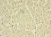 Immunohistochemistry of paraffin-embedded human heart tissue using CSB-PA818236LA01HU at dilution of 1:100