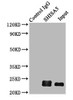 Immunoprecipitating SHISA5 in HepG2 whole cell lysate<br />
 Lane 1: Rabbit control IgG (1µg) instead of CSB-PA818677LA01HU in HepG2 whole cell lysate.
 For western blotting, a HRP-conjugated Protein G antibody was used as the secondary antibody (1/2000) <br />
 Lane 2: CSB-PA818677LA01HU (6µg) + HepG2 whole cell lysate (500µg) <br />
 Lane 3: HepG2 whole cell lysate (10µg) <br />