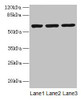 Western blot<br />
 All lanes: MIER2 antibody at 4µg/ml<br />
 Lane 1: Jurkat whole cell lysate<br />
 Lane 2: HepG2 whole cell lysate<br />
 Lane 3: A549 whole cell lysate<br />
 Secondary<br />
 Goat polyclonal to rabbit IgG at 1/10000 dilution<br />
 Predicted band size: 60 kDa<br />
 Observed band size: 60 kDa<br />