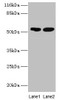 Western blot<br />
 All lanes: SVOPL antibody at 2µg/ml<br />
 Lane 1: Mouse liver tissue<br />
 Lane 2: Rat liver tissue<br />
 Secondary<br />
 Goat polyclonal to rabbit IgG at 1/10000 dilution<br />
 Predicted band size: 54, 37 kDa<br />
 Observed band size: 54 kDa<br />