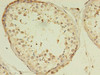 Immunohistochemistry of paraffin-embedded human testis tissue using CSB-PA818719LA01HU at dilution of 1:100 Immunohistochemistry of paraffin-embedded human testis tissue using CSB-PA818719LA01HU at dilution of 1:100