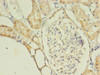 Immunohistochemistry of paraffin-embedded human kidney tissue using CSB-PA818719LA01HU at dilution of 1:100 Immunohistochemistry of paraffin-embedded human kidney tissue using CSB-PA818719LA01HU at dilution of 1:100