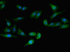 Immunofluorescent analysis of Hela cells using CSB-PA818730LA01HU at dilution of 1:100 and Alexa Fluor 488-congugated AffiniPure Goat Anti-Rabbit IgG (H+L)
