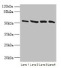 Western blot<br />
 All lanes: CCDC112 antibody at 12µg/ml<br />
 Lane 1: Jurkat whole cell lysate<br />
 Lane 2: Hela whole cell lysate<br />
 Lane 3: HepG2 whole cell lysate<br />
 Lane 4: A549 whole cell lysate<br />
 Secondary<br />
 Goat polyclonal to rabbit IgG at 1/10000 dilution<br />
 Predicted band size: 54, 62 kDa<br />
 Observed band size: 54 kDa<br />