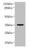 Western blot<br />
 All lanes: NUBPL antibody at 1µg/ml + A431 whole cell lysate<br />
 Secondary<br />
 Goat polyclonal to rabbit IgG at 1/10000 dilution<br />
 Predicted band size: 35, 19 kDa<br />
 Observed band size: 35 kDa<br />