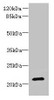 Western blot<br />
 All lanes: DYDC1 antibody at 4µg/ml + Hela whole cell lysate<br />
 Secondary<br />
 Goat polyclonal to rabbit IgG at 1/10000 dilution<br />
 Predicted band size: 21, 22 kDa<br />
 Observed band size: 21 kDa<br />