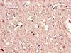 Immunohistochemistry of paraffin-embedded human brain tissue using CSB-PA822194LA01HU at dilution of 1:100