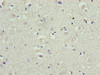Immunohistochemistry of paraffin-embedded human brain tissue using CSB-PA822685LA01HU at dilution of 1:100