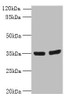 Western blot<br />
 All lanes: OSR2 antibody at 7µg/ml<br />
 Lane 1: Jurkat whole cell lysate<br />
 Lane 2: Hela whole cell lysate<br />
 Secondary<br />
 Goat polyclonal to rabbit IgG at 1/10000 dilution<br />
 Predicted band size: 36, 31, 49 kDa<br />
 Observed band size: 36 kDa<br />
