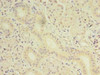 Immunohistochemistry of paraffin-embedded human pancreatic tissue using CSB-PA822691LA01HU at dilution of 1:100