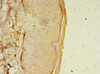 Immunohistochemistry of paraffin-embedded human skin tissue using CSB-PA822691LA01HU at dilution of 1:100