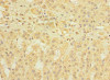 Immunohistochemistry of paraffin-embedded human adrenal gland tissue using CSB-PA823476LA01HU at dilution of 1:100 Immunohistochemistry of paraffin-embedded human adrenal gland tissue using CSB-PA823476LA01HU at dilution of 1:100