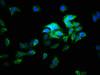 Immunofluorescence staining of HepG2 cells with CSB-PA836175LA01HU at 1:166, counter-stained with DAPI. The cells were fixed in 4% formaldehyde, permeabilized using 0.2% Triton X-100 and blocked in 10% normal Goat Serum. The cells were then incubated with the antibody overnight at 4°C. The secondary antibody was Alexa Fluor 488-congugated AffiniPure Goat Anti-Rabbit IgG (H+L) . Immunofluorescence staining of HepG2 cells with CSB-PA836175LA01HU at 1:166, counter-stained with DAPI. The cells were fixed in 4% formaldehyde, permeabilized using 0.2% Triton X-100 and blocked in 10% normal Goat Serum. The cells were then incubated with the antibody overnight at 4°C. The secondary antibody was Alexa Fluor 488-congugated AffiniPure Goat Anti-Rabbit IgG (H+L) .