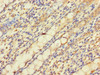 Immunohistochemistry of paraffin-embedded human colon tissue using CSB-PA836180LA01HU at dilution of 1:100