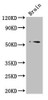 Western Blot<br />
 Positive WB detected in: Mouse brain tissue<br />
 All lanes: TRIM43 antibody at 3µg/ml<br />
 Secondary<br />
 Goat polyclonal to rabbit IgG at 1/50000 dilution<br />
 Predicted band size: 53 kDa<br />
 Observed band size: 53 kDa<br />