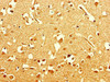 Immunohistochemistry of paraffin-embedded human brain tissue using CSB-PA836246LA01HU at dilution of 1:100