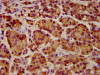 IHC image of CSB-PA836246LA01HU diluted at 1:1000 and staining in paraffin-embedded human pancreatic cancer performed on a Leica BondTM system. After dewaxing and hydration, antigen retrieval was mediated by high pressure in a citrate buffer (pH 6.0) . Section was blocked with 10% normal goat serum 30min at RT. Then primary antibody (1% BSA) was incubated at 4°C overnight. The primary is detected by a biotinylated secondary antibody and visualized using an HRP conjugated SP system.