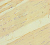 Immunohistochemistry of paraffin-embedded human skeletal muscle tissue using CSB-PA836691LA01HU at dilution of 1:100