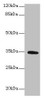 Western blot<br />
 All lanes: SETD9 antibody at 6µg/ml + K562 whole cell lysate<br />
 Secondary<br />
 Goat polyclonal to rabbit IgG at 1/10000 dilution<br />
 Predicted band size: 35, 31 kDa<br />
 Observed band size: 35 kDa<br /> Western blot<br />
 All lanes: SETD9 antibody at 6µg/ml + K562 whole cell lysate<br />
 Secondary<br />
 Goat polyclonal to rabbit IgG at 1/10000 dilution<br />
 Predicted band size: 35, 31 kDa<br />
 Observed band size: 35 kDa<br />
