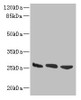 Western blot<br />
 All lanes: DNAJB8 antibody at 8µg/ml<br />
 Lane 1: Hela whole cell lysate<br />
 Lane 2: Mouse brain tissue<br />
 Lane 3: Mouse liver tissue<br />
 Secondary<br />
 Goat polyclonal to rabbit IgG at 1/10000 dilution<br />
 Predicted band size: 26 kDa<br />
 Observed band size: 26 kDa<br />