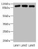 Western blot<br />
 All lanes: ASAP3 antibody at 1µg/ml<br />
 Lane 1: A549 whole cell lysate<br />
 Lane 2: MCF-7 whole cell lysate<br />
 Lane 3: K562 whole cell lysate<br />
 Secondary<br />
 Goat polyclonal to rabbit IgG at 1/10000 dilution<br />
 Predicted band size: 100, 44, 98 kDa<br />
 Observed band size: 100 kDa<br /> Western blot<br />
 All lanes: ASAP3 antibody at 1µg/ml<br />
 Lane 1: A549 whole cell lysate<br />
 Lane 2: MCF-7 whole cell lysate<br />
 Lane 3: K562 whole cell lysate<br />
 Secondary<br />
 Goat polyclonal to rabbit IgG at 1/10000 dilution<br />
 Predicted band size: 100, 44, 98 kDa<br />
 Observed band size: 100 kDa<br />