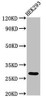 Western Blot<br />
 Positive WB detected in: HEK293 whole cell lysate<br />
 All lanes: ANKRD49 antibody at 3µg/ml<br />
 Secondary<br />
 Goat polyclonal to rabbit IgG at 1/50000 dilution<br />
 Predicted band size: 28 kDa<br />
 Observed band size: 28 kDa<br />