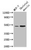 Western Blot<br />
 Positive WB detected in: MCF-7 whole cell lysate, Mouse skeletal muscle tissue<br />
 All lanes: ARRDC3 antibody at 4µg/ml<br />
 Secondary<br />
 Goat polyclonal to rabbit IgG at 1/50000 dilution<br />
 Predicted band size: 47 kDa<br />
 Observed band size: 47 kDa<br />