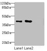 Western blot<br />
 All lanes: MRGPRX2 antibody at 5µg/ml<br />
 Lane 1: 293T whole cell lysate<br />
 Lane 2: Mouse liver tissue<br />
 Lane 3: MCF-7 whole cell lysate<br />
 Secondary<br />
 Goat polyclonal to rabbit IgG at 1/10000 dilution<br />
 Predicted band size: 38 kDa<br />
 Observed band size: 38 kDa<br />