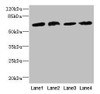 Western blot<br />
 All lanes: CEP63 antibody at 12µg/ml<br />
 Lane 1: K562 whole cell lysate<br />
 Lane 2: Hela whole cell lysate<br />
 Lane 3: NIH/3T3 whole cell lysate<br />
 Lane 4: Raji whole cell lysate<br />
 Secondary<br />
 Goat polyclonal to rabbit IgG at 1/10000 dilution<br />
 Predicted band size: 82, 64, 58, 56 kDa<br />
 Observed band size: 64 kDa<br />