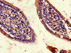 Immunohistochemistry of paraffin-embedded human small intestine tissue using CSB-PA839803LA01HU at dilution of 1:100