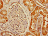 Immunohistochemistry of paraffin-embedded human kidney tissue using CSB-PA839815LA01HU at dilution of 1:100