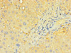 Immunohistochemistry of paraffin-embedded human liver tissue using CSB-PA840561LA01HU at dilution of 1:100