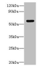 Western blot<br />
 All lanes: SLC35F5 antibody at 6µg/ml + Hela whole cell lysate<br />
 Secondary<br />
 Goat polyclonal to rabbit IgG at 1/10000 dilution<br />
 Predicted band size: 59, 28 kDa<br />
 Observed band size: 59 kDa<br />